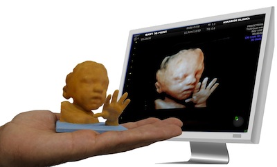 Escala real de la impresión de las ecografías en 3D de Baby3dprint