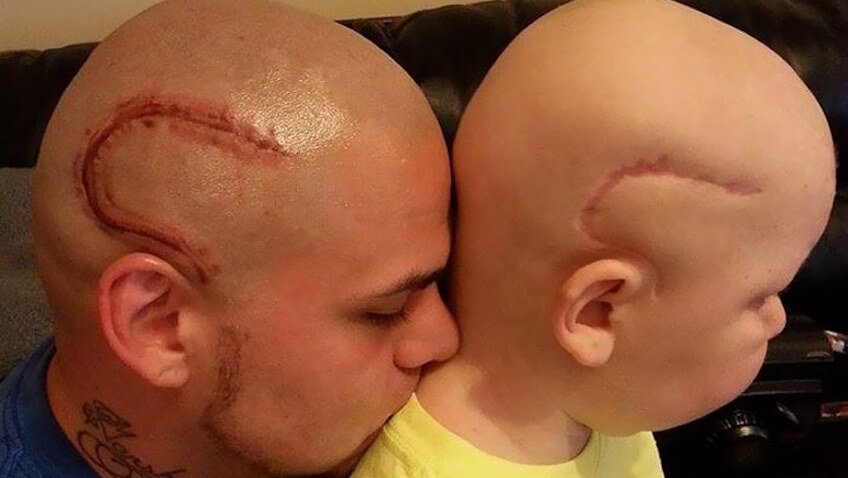 padre se tatua la cabeza por su hijo (1)
