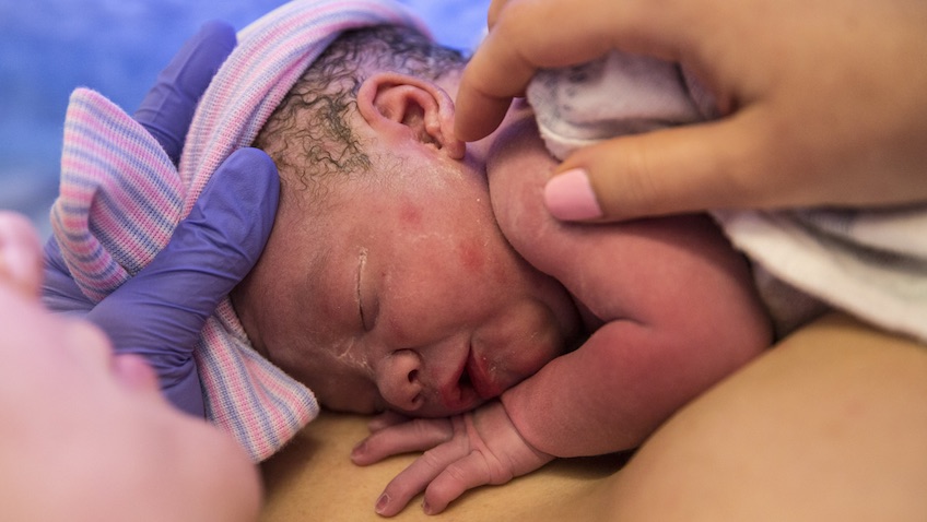 segundo bebé nacido por transplante de útero en Dallas EEUU