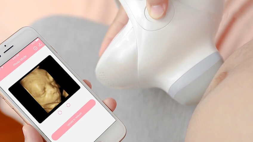 cámara fetal para fotos del bebé durante el embarazo