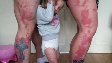 La «familia tatuaje» así les llaman tras tatuarse una mancha como la de su hija