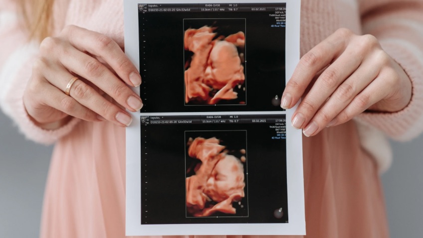 primerizas embarazadas documenta cada hito