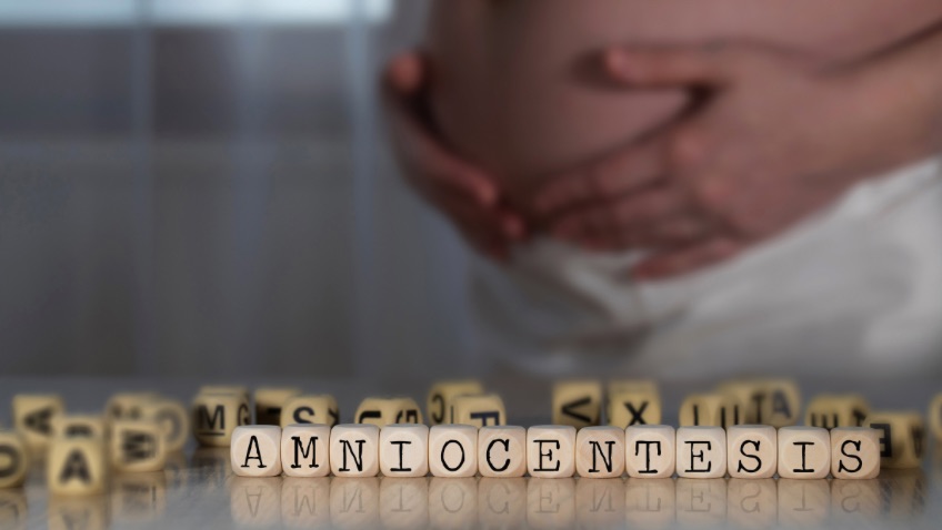 Amniocentesis procedimiento para el diagnóstico prenatal