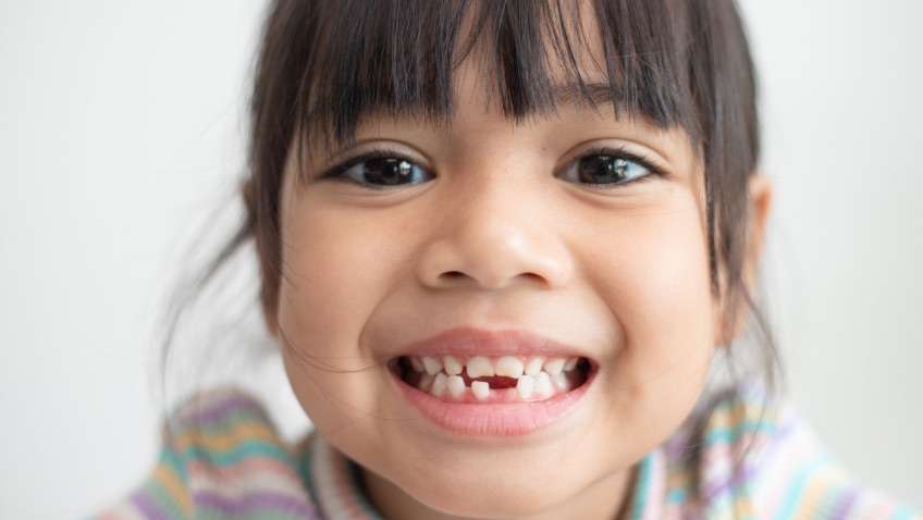 Por qué pierden los dientes los niños